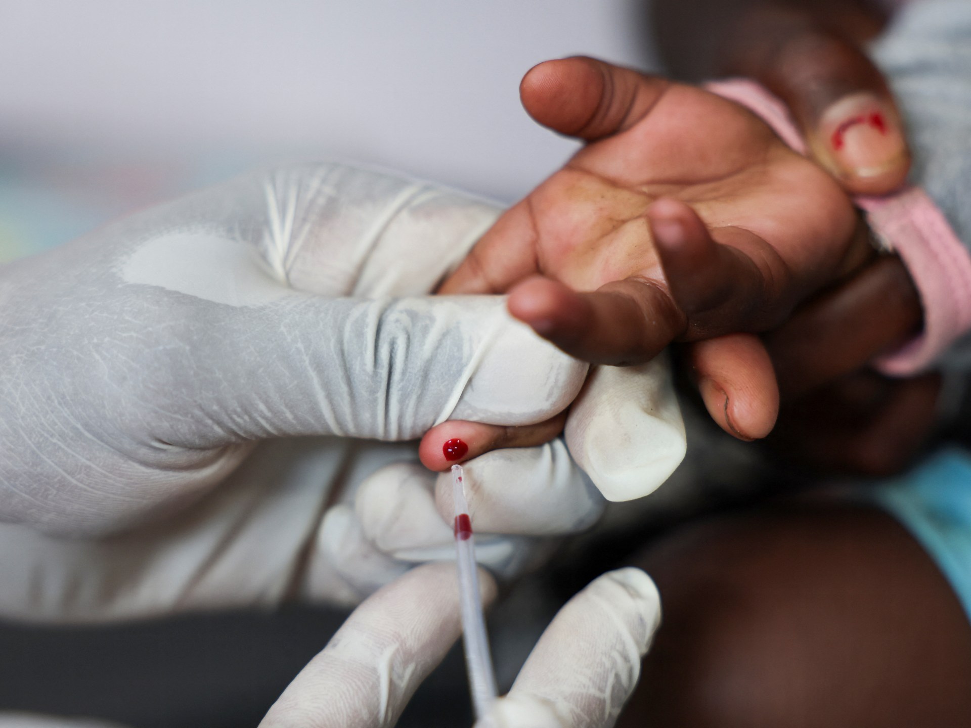 JAV pagalbos mažinimas gali lemti milijonus papildomų mirčių nuo AIDS