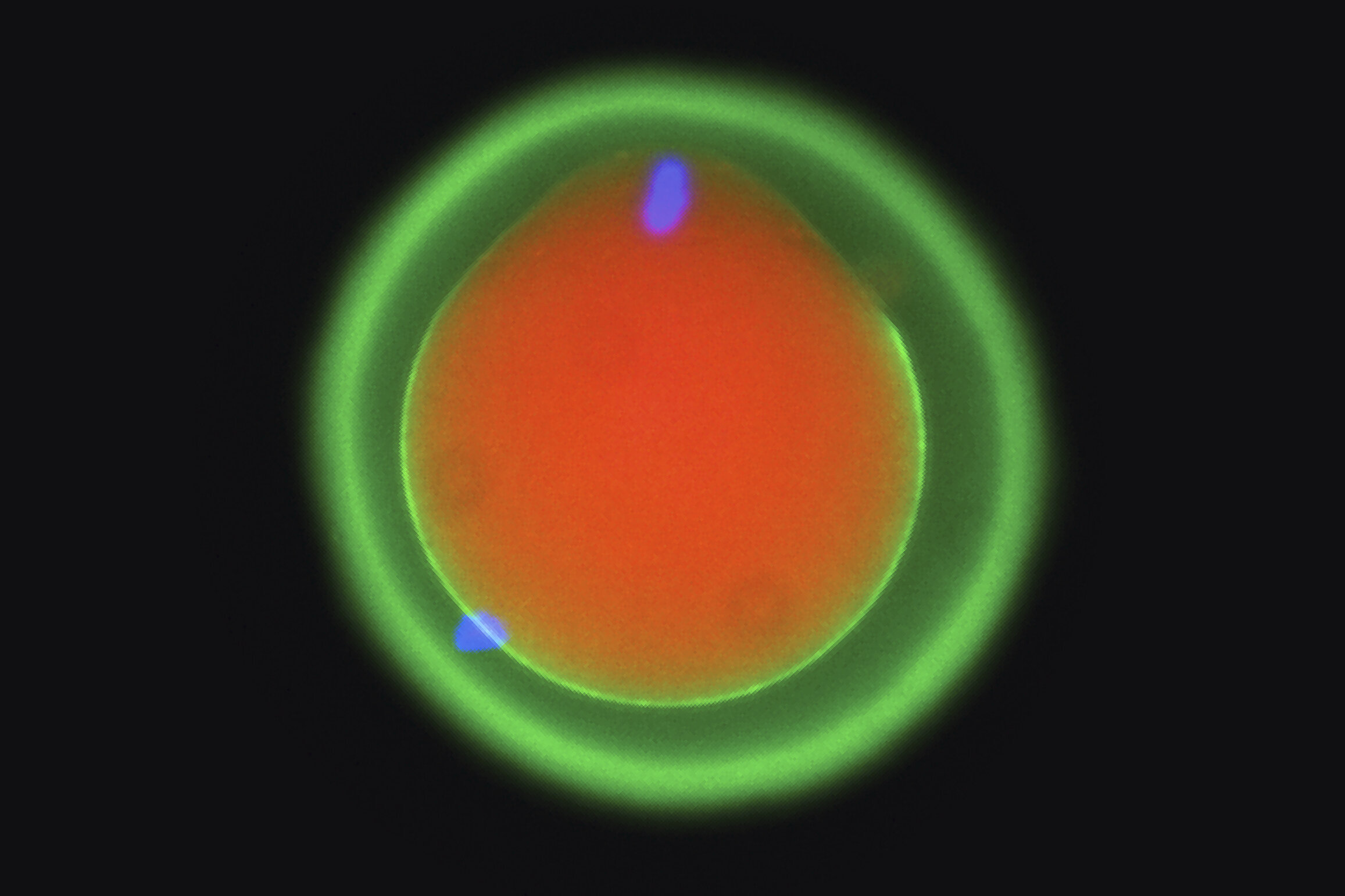 Austrian Scientists Unlock the Sperm-Egg Fusion Code